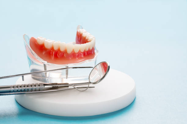 Dental Inlays and Onlays in Mccleary, WA